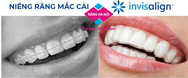 nieng rang trong suót